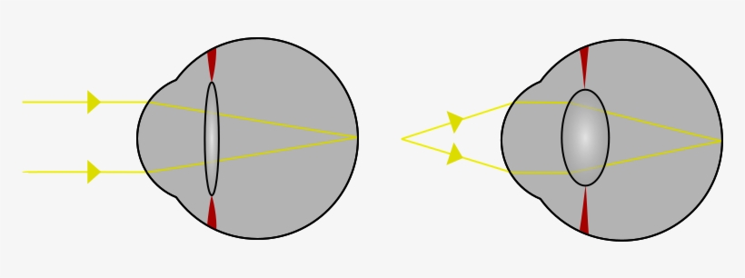 Focus In An Eye - Eye Lens Accommodation - Free Transparent PNG ...