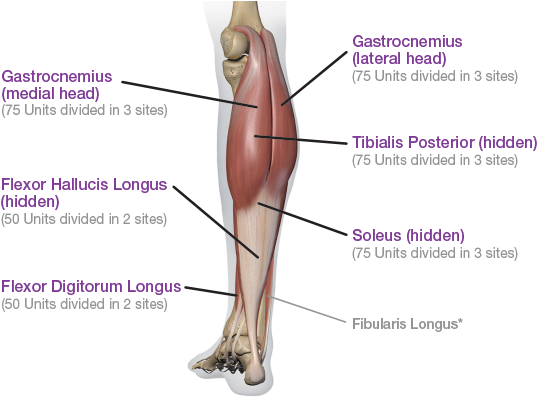 Download Posterior View - Lower Extremity Botox PNG Image with No ...