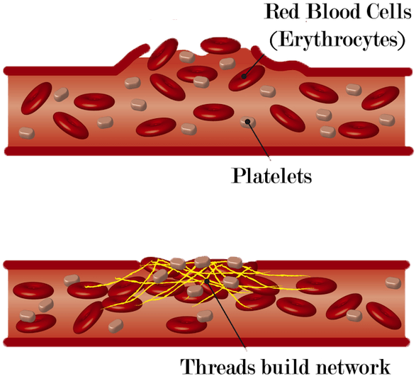 Download Blood Clot Formation - Damage Of Blood Vessels PNG Image with ...