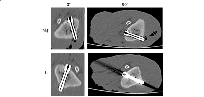 Mg Screw And Ti Screw (bottom) In Mdct In - Common Fig (850x405), Png Download