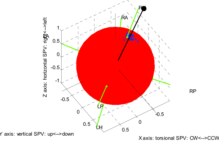 The Unit Sphere Model For The Spontaneous Nystagmus (733x473), Png Download
