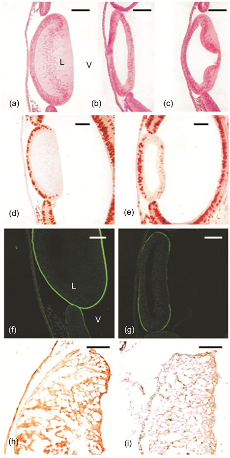 Micrographs Of Middle Sections Of Chick Lens Anlagen (903x931), Png Download