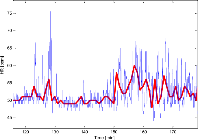 Download Heart Rate From The Ppg Sensor Of Somnoscreen And Basis ...