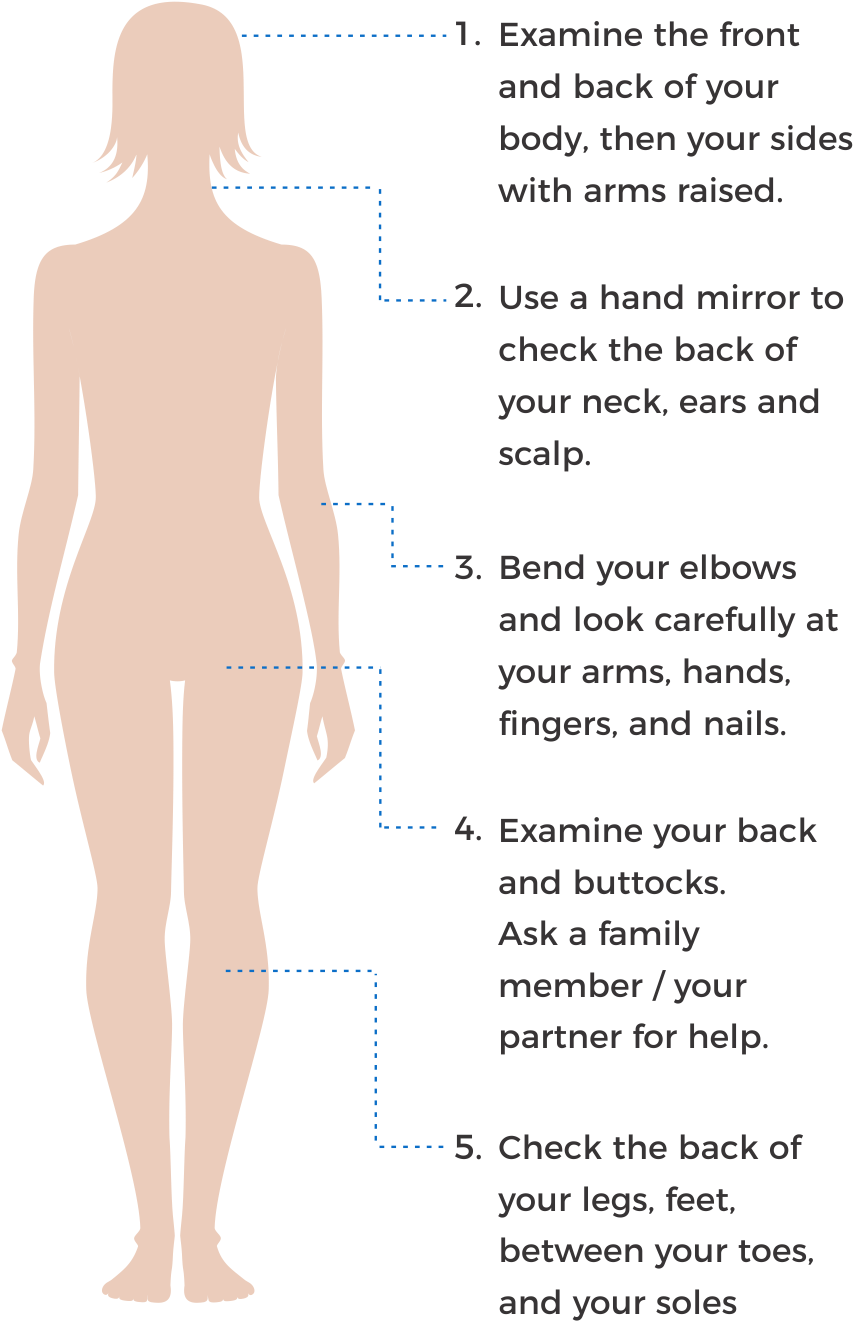 How To Check Your Skin Spots - Standing (890x1376), Png Download